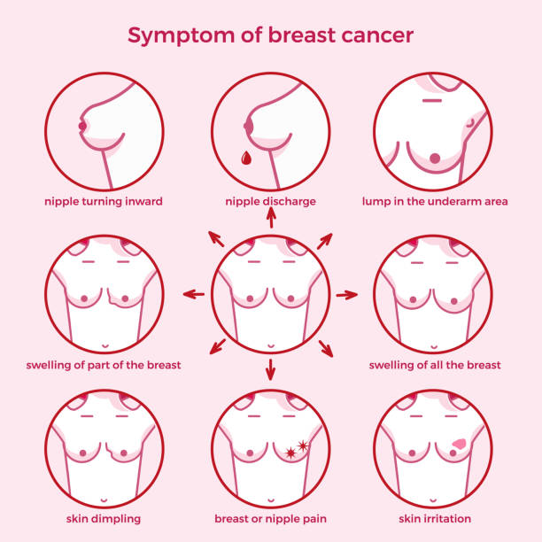 breast cancer symptoms