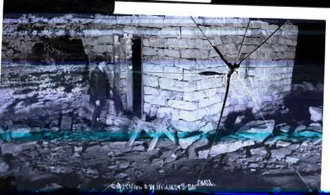 Tuberculosis cabin in Mammoth